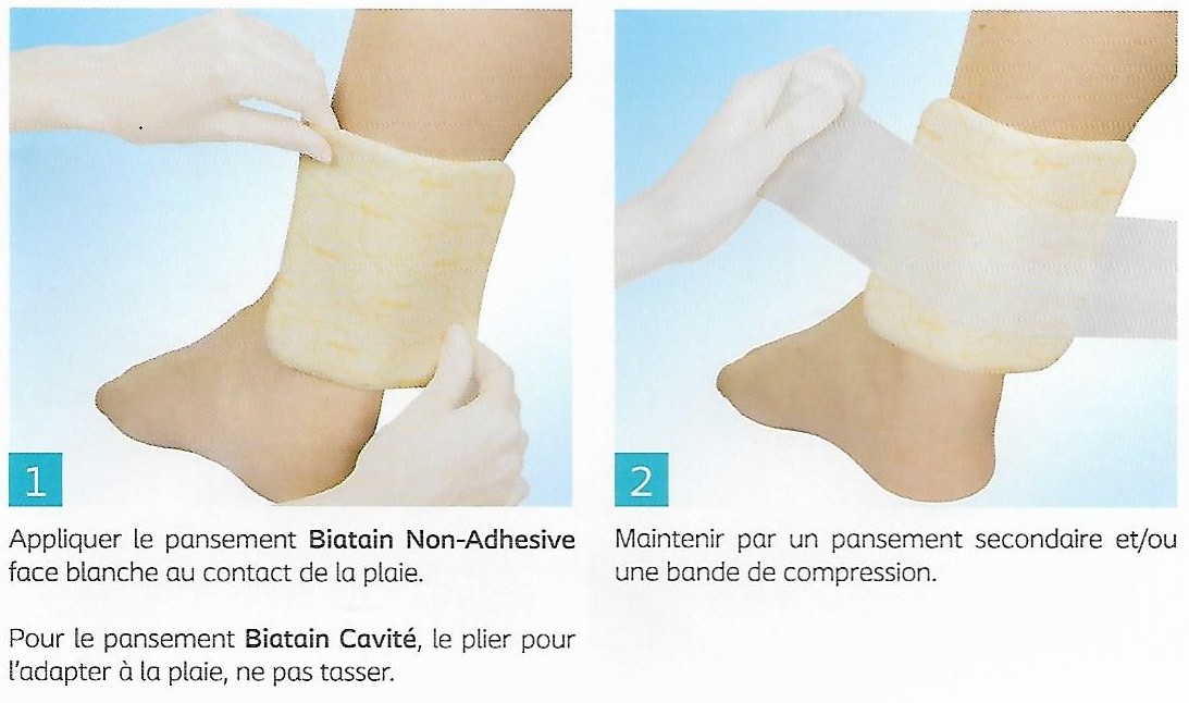BIATAIN NON ADHESIF 10 X 20 Cm Pansement Hydrocellulaire Absorbant biatain-non-adhesif-10-x-20-cm-pansement-hydrocellulaire-absorbant