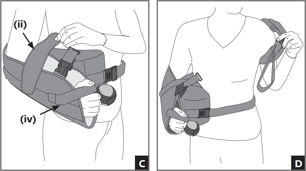 Immobilisation d'Épaule - ULTRASLING PRO ER 30° - DJO - Epaule & Coude -  Univers Santé