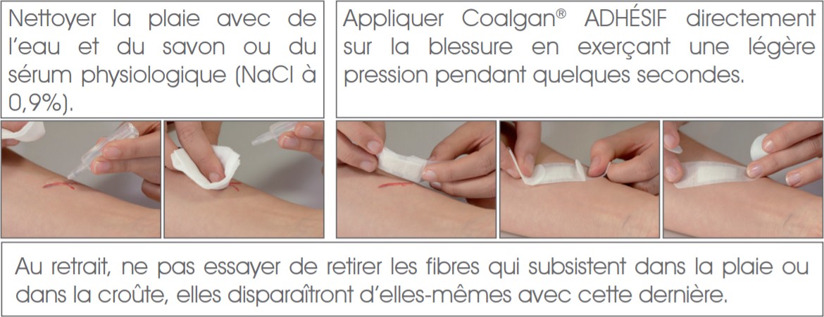 BROTHIER - COALGAN ADHESIF - Pansement à l' Alginate de Calcium pour A