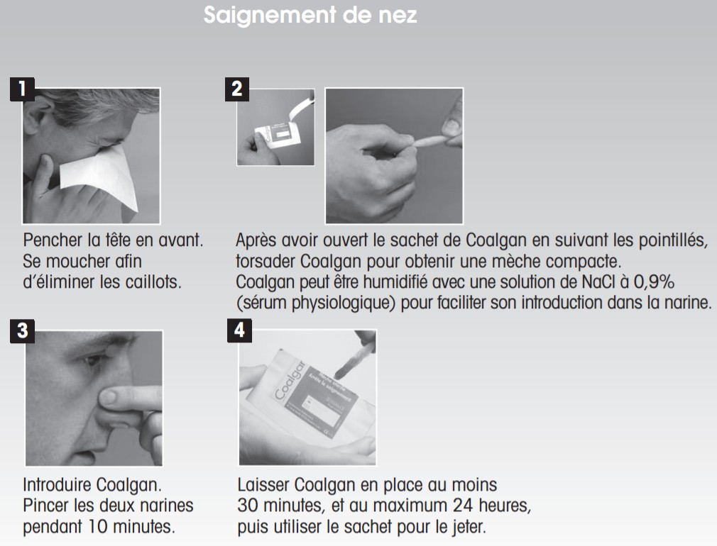 Coalgan mèche hémostatique et cicatrisante, boite de 5 mèches