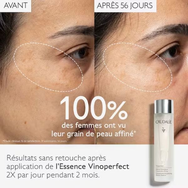 CAUDALIE VINOPERFECT Essence Glycolique Concentré d' Eclat 150ml - Soin Anti Tâches - Toutes Peaux