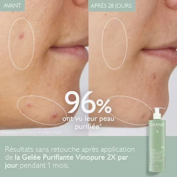 VINOPURE BIO Gelée Nettoyante Purifiante 385ml - Peaux Mixtes à Tendance Acnéique